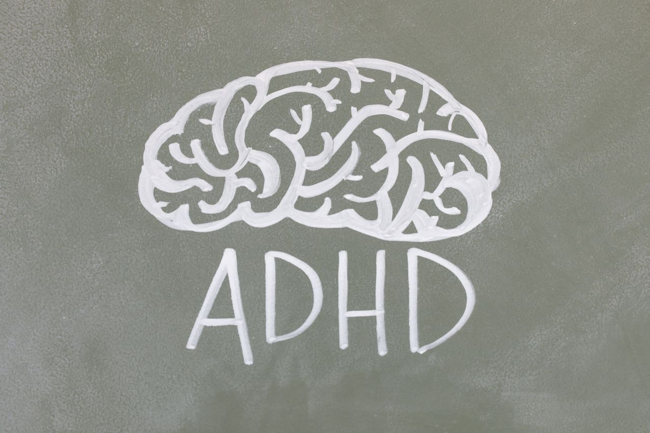 Bild på en ritad hjärna och under hjärnan står det "ADHD"